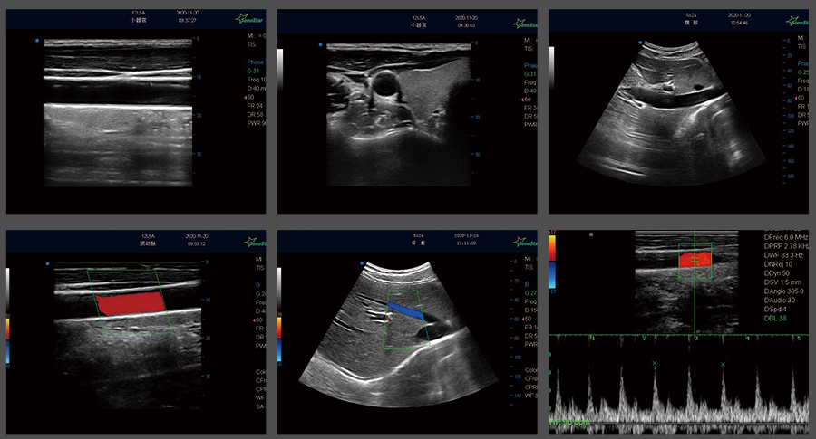 mini ultrasound scanner