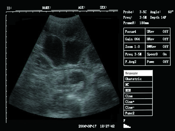 vet ultrasound portable