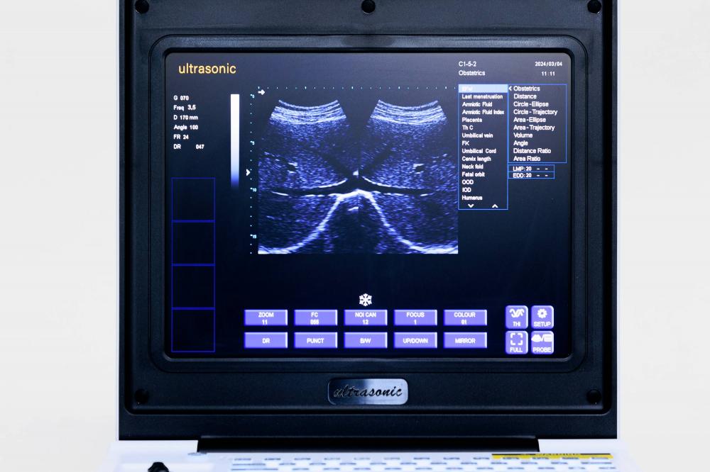 Ультрагукавы экран ноўтбука 2 Laptop Ultrasound Screen 2