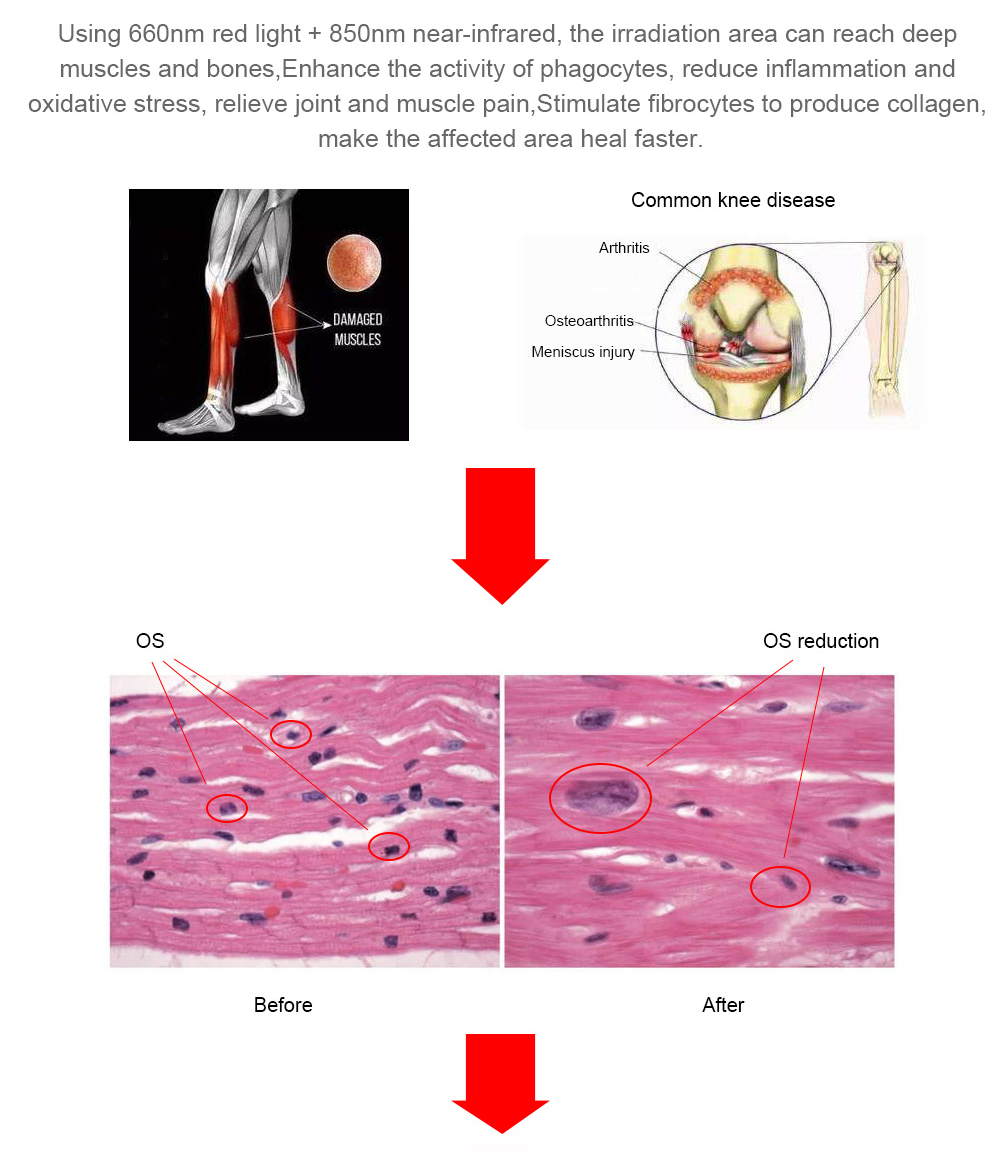 Light therapy bed (6).png