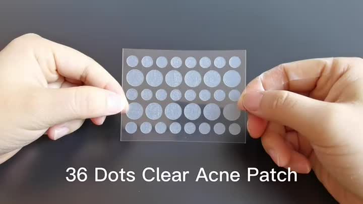 Hydrocolloid acne patch