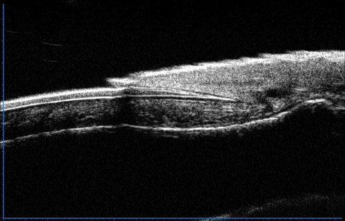 Ultrasound Biomicroscopy Microscope machine