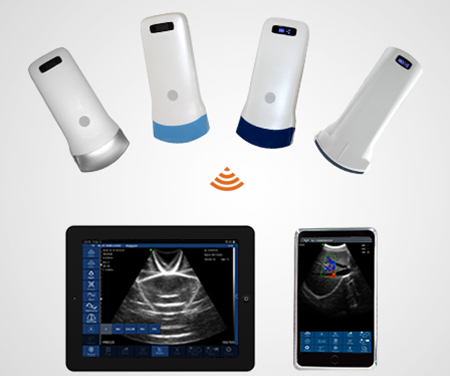 wifi ultrasound