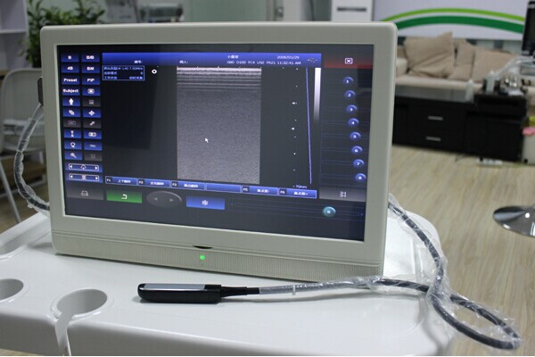 Portable ultrasound