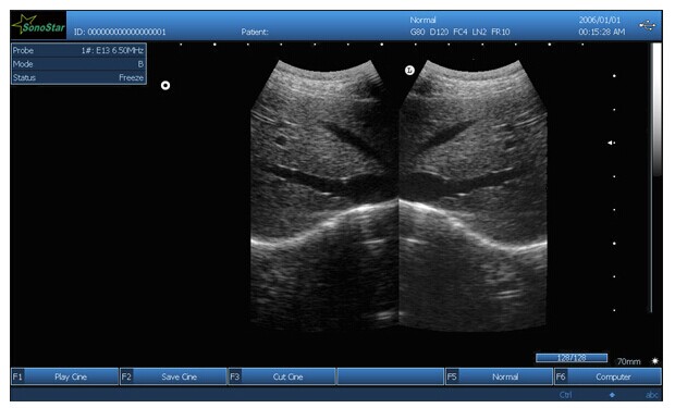 Black and White Ultrasound Box