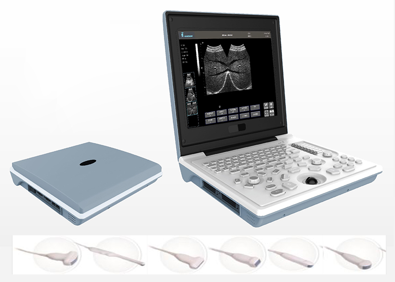 portable ultrasound