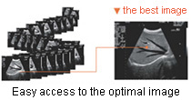 vet ultrasound scanner