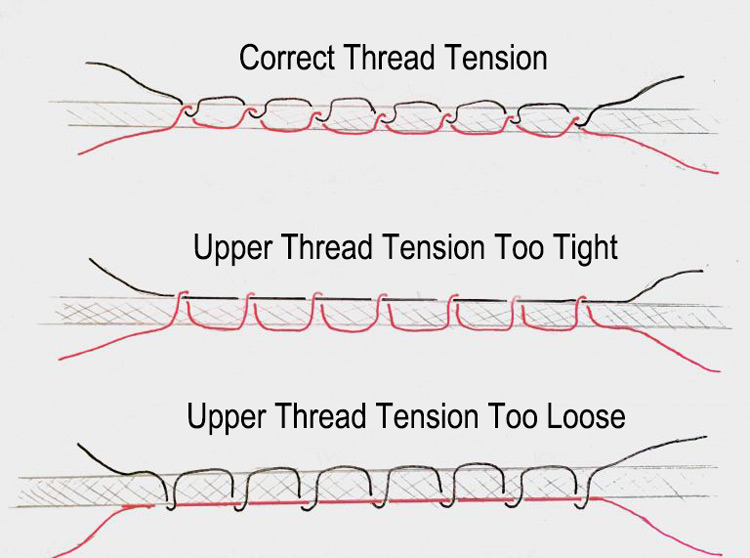 needle-thread-tension