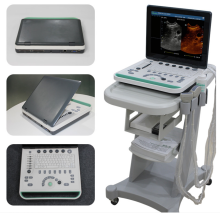 3D Laptop Ultrasound Scanner
