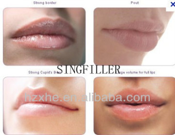 CE sodium hyaluronate acid lip derm filler