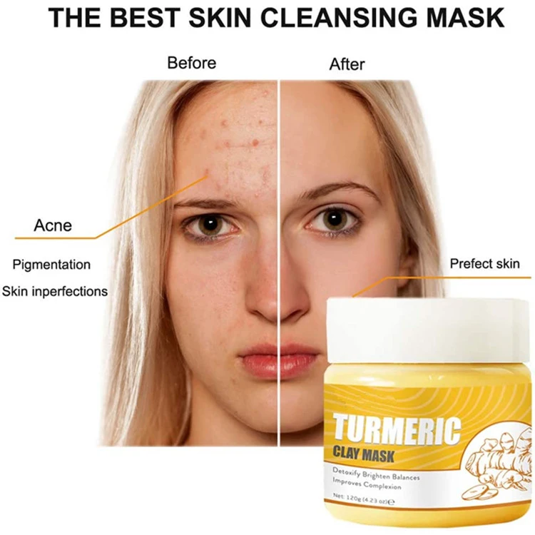 Turmeric Clay Face Mask Skin Brightening Lightening Acne Scars Masks