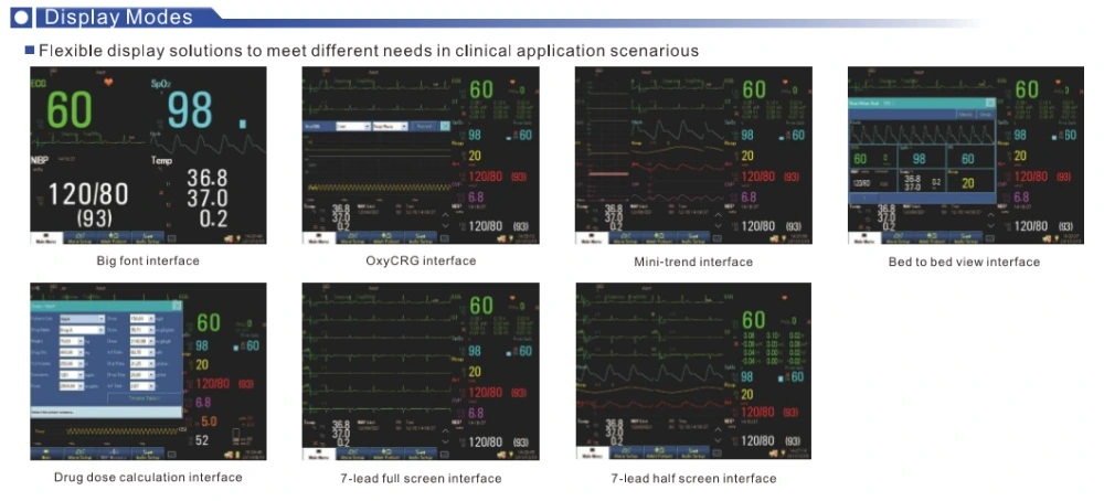 Medical Hospital Equipments Multi-Parameter Patient Monitor