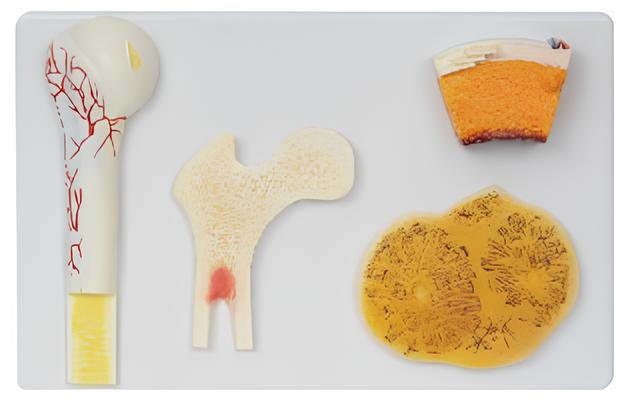 Bone structure model