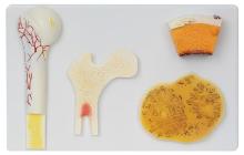 Bone structure model