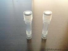 Syphilis-TP17 Recombinant Antigens Infectious Disease for v