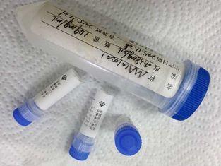 Anti - HBsAg Mouse Monoclonal Antibody Mab Antibodies For M