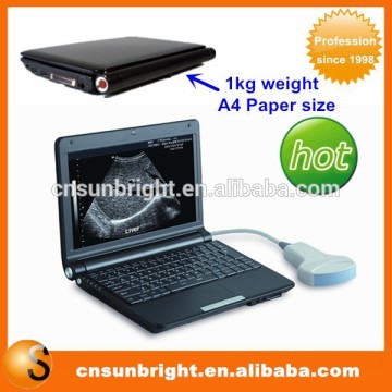 Portable easy carry USB ultrasound machine SUN-806F