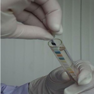 Urine Leukocyte Test Strips