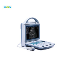 MEIDI Portable Medical Full Digital Diagnostic Cheap B Scan Ultrasound Machine Human Ultrasound Scanner