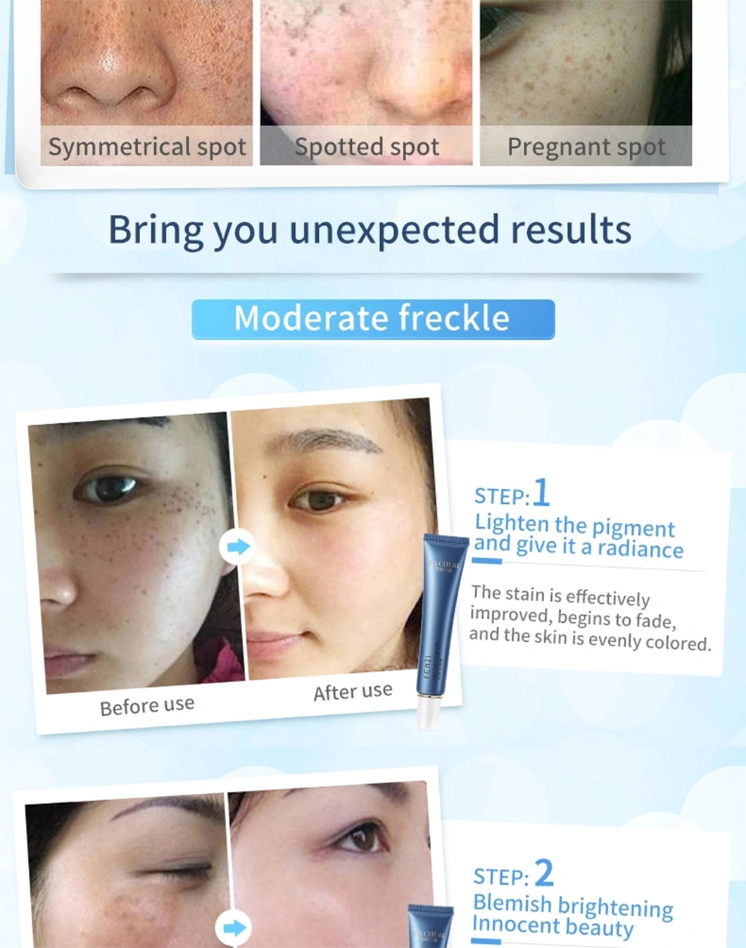 Professional Skin Care Anti Freckle Face Cream