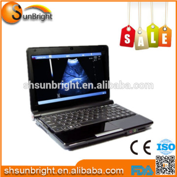 price laptop ultrasound,price ultrasound scanner