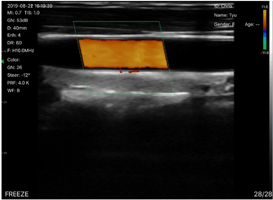 Wireless Portable Color Doppler Ultrasound Convex Probe