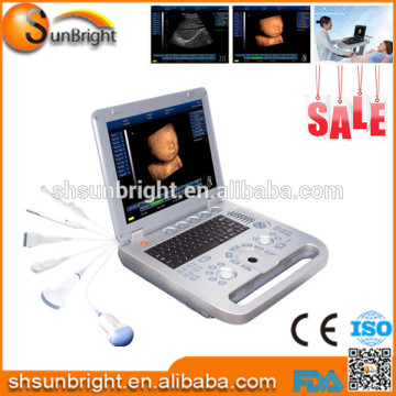 ultrasound price/portable ultrasound 4d color ultrasound, ultrasound