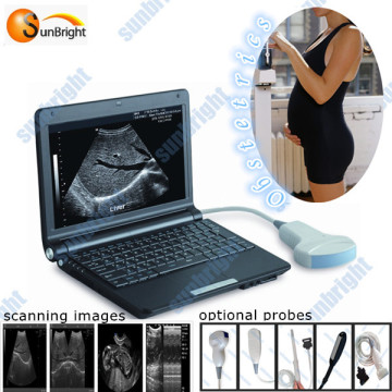 LCD Laptop ultrasonic machine ultrasound equipment