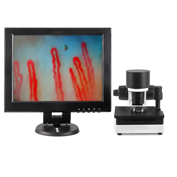 Capillaroscope Vessel Microscope Machine 12 pulgadas LCD