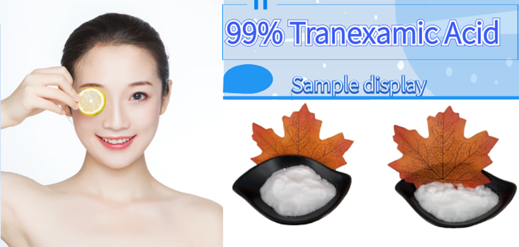 tranexamic acid