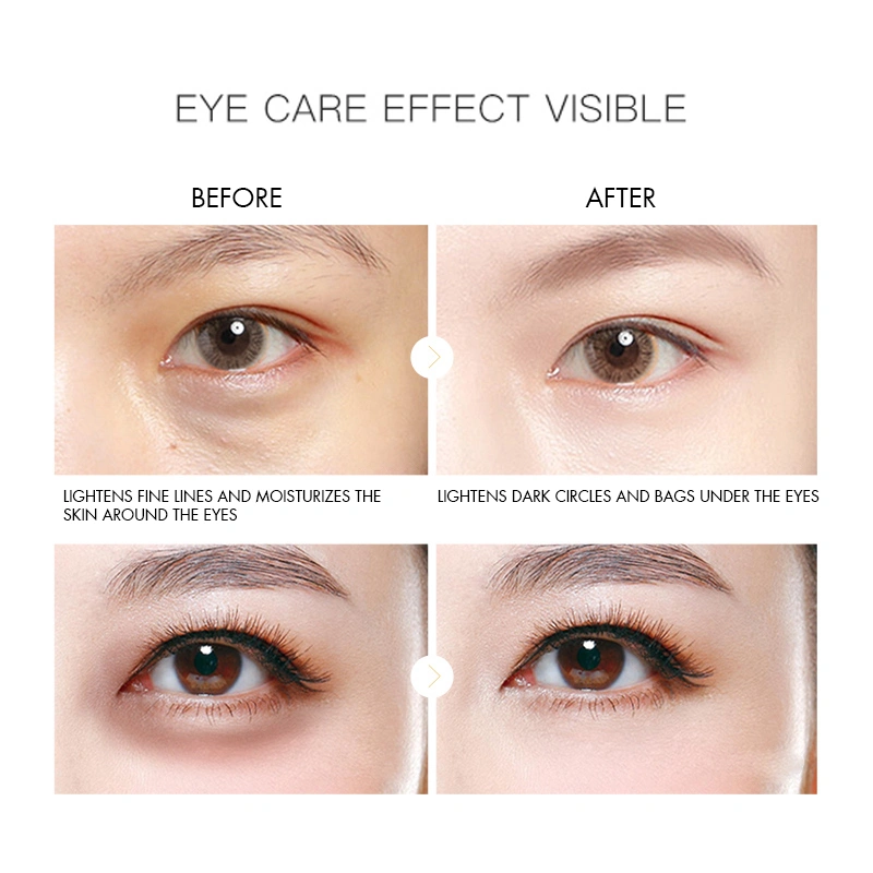 OEM Private Label Eye Cream Anti-Wrinkle Moisturizing Lifting Eye Cream for Eye Care