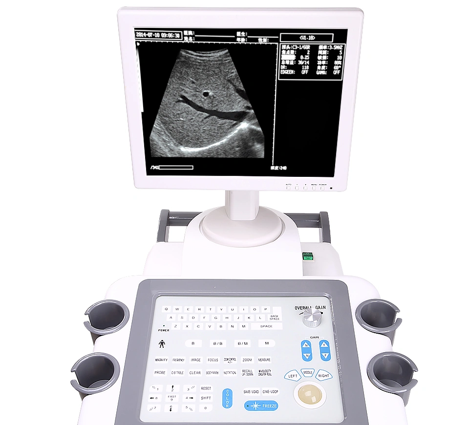 L-2018cii Animal Device Trolley Ultrasound Scanner for Animal Clinic