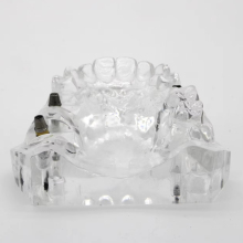 Dental Implant Model Overdenture Restoration Dental Teeth Model Factory Shop On Sale High Quality