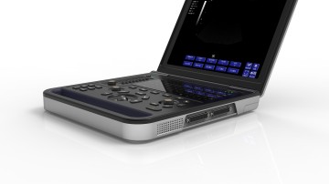 mobile doppler ultrasound