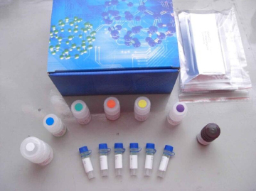 Bovine Interferon γ ,IFN-γ ELISA Kit