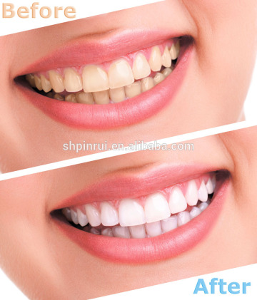 Dental bleaching machine, teeth whitener