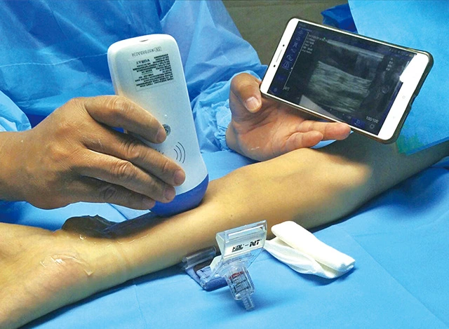 Waterproof Wireless Ultrasound Probe