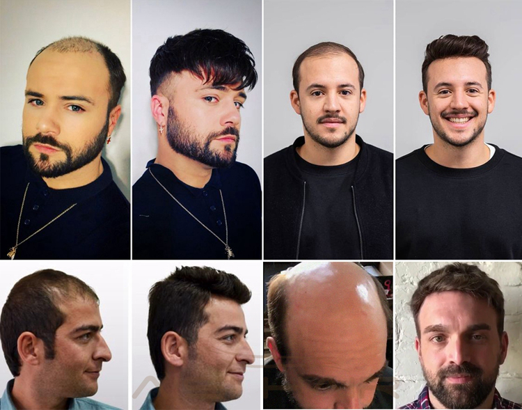Free Sample Vendors Pixie Cut For Men  Cuticle Aligned Wholesale Toupee Brazilian Extension Human Hair Wigs