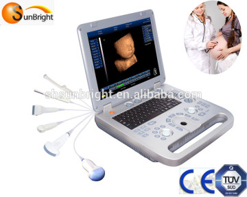 Laptop 4D Ultrasound With CE