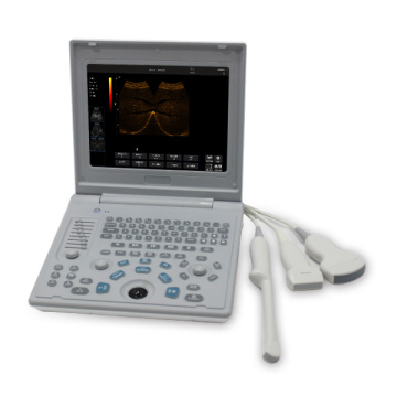 Sonostar SS-6B Ultrasound Machine