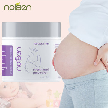 Best Cream for Stretch Marks and Pregnancy Acne: Moisturizes, Removes, and Prevents Scars