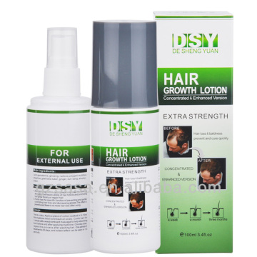 manufacturer hair loss product 100ML DSY anti hair loss / indian hair loss