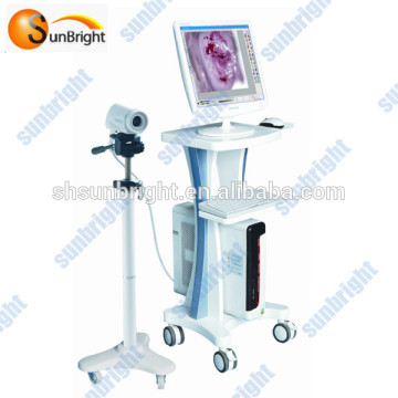 Gynaecology Digital Optical Colposcope