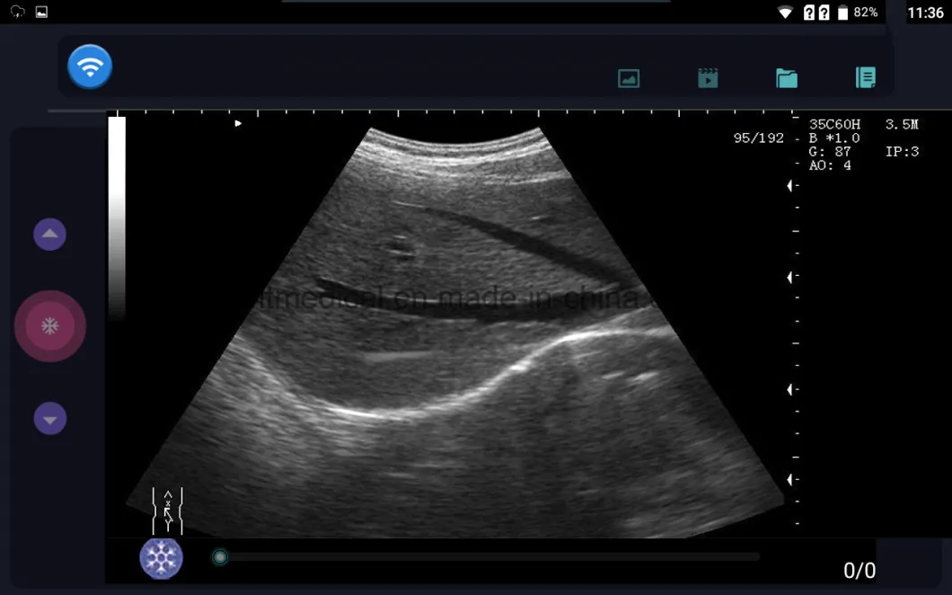 Probes Convex and Linear Portable Ultrasound Machine for Pregnancy / Medical Hospital Ultrasound Scanner