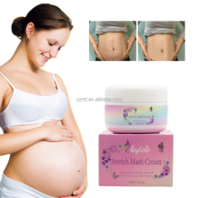 Natural Stretch Mark Cream for Pregnancy: Repair Scar and Remove Abdomen Stretch Marks