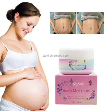 Natural Stretch Mark Cream for Pregnancy: Repair Scar and Remove Abdomen Stretch Marks