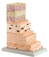 Gastric Wall Hierarchical Model
