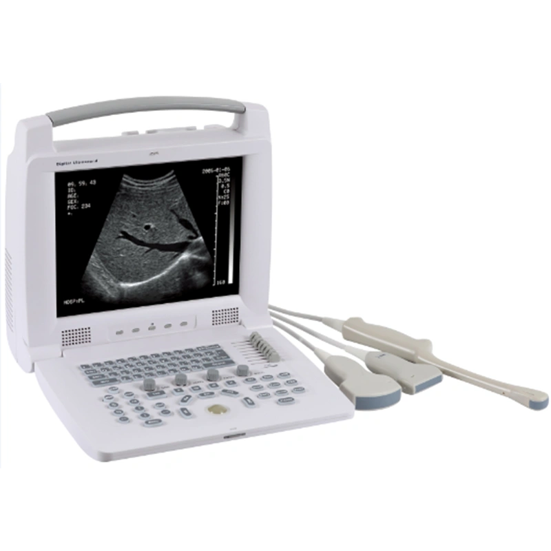 Black/White Full Digital Portable Ultrasound Scanner