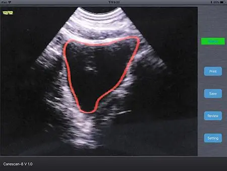 New Brand 4D Wireless Ultrasound for Hospital or Clinic