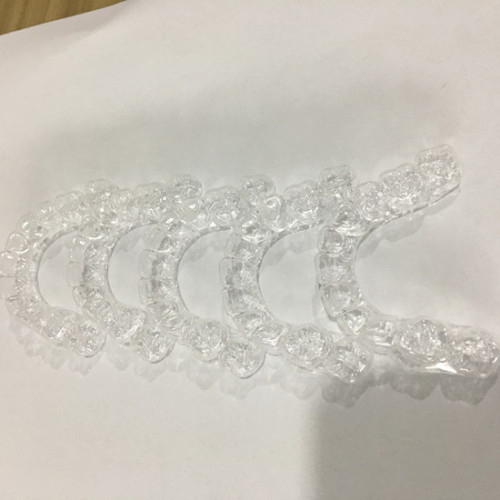 Modello di denti stampati in 3D